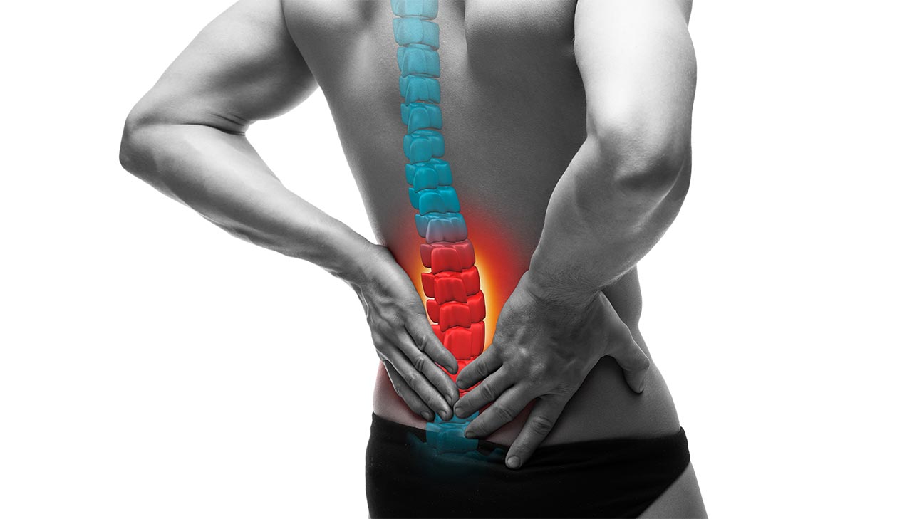 Herniated Disc